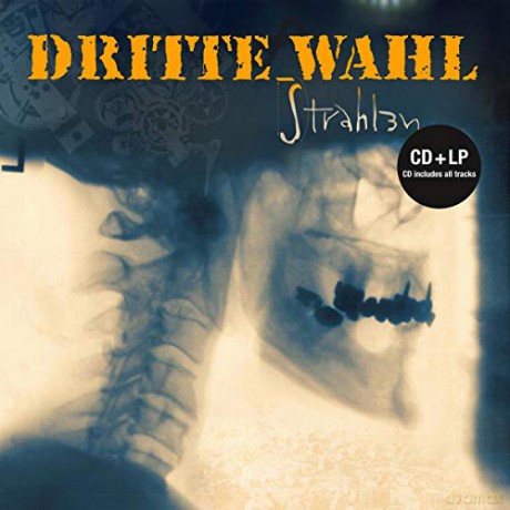 Dritte Wahl: Strahlen [2xWinyl]