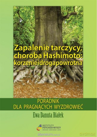 Zapalenie tarczycy, choroba Hashimoto - Ewa Danuta Białek [KSIĄŻKA]