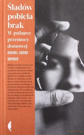 Śladów pobicia brak - Rachel Louise Snyder [KSIĄŻKA]