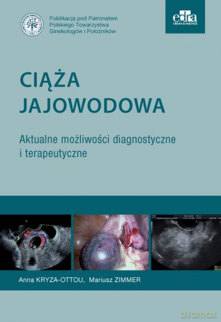 Ciąża jajowodowa Aktualne możliwości diagnostyczne i terapeutyczne - A. Kryza-Ottou, M. Zimmer [KSIĄŻKA]