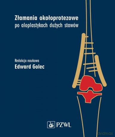 Złamania okołoprotezowe po aloplastykach dużych stawów - Edward Golec [KSIĄŻKA]
