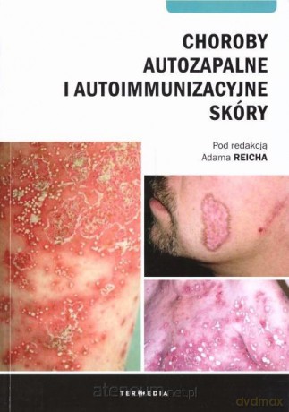 Choroby autozapalne i autoimmunizacyjne skóry [KSIĄŻKA]