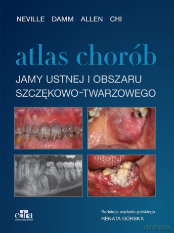 Atlas chorób jamy ustnej i obszaru szczękowo-twarzowego - Damm N., A. Chi [KSIĄŻKA]