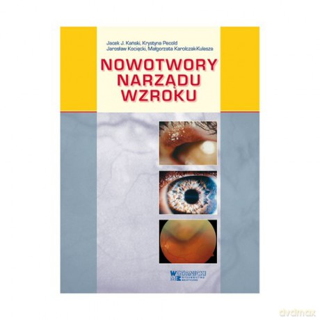 Nowotwory narządu wzroku - J. Kański Jacek, Krystyna Pecold [KSIĄŻKA]