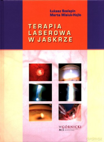 Terapia laserowa w jaskrze - Łukasz Szelepin, Marta Misiuk-Hojło [KSIĄŻKA]