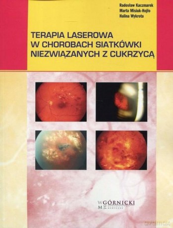 Terapia laserowa w chorobach siatkówki niezwiązanych z cukrzycą - Radosław Kaczmarek, Marta Misiuk-Hojło [KSIĄŻKA]