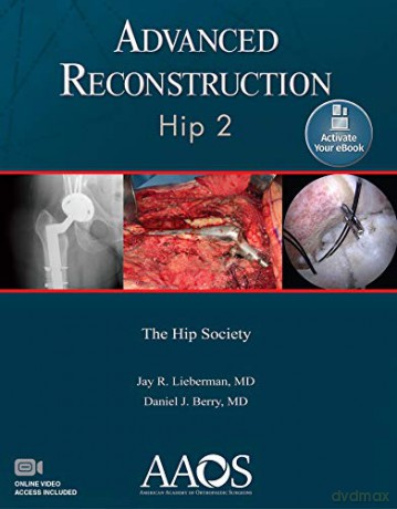 Advanced Reconstruction: Hip 2: Print + Ebook with Multimedia (AAOS - American Academy of Orthopaedic Surgeons) - Jay R. Lieberman [KSIĄŻKA]
