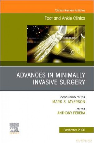 Advances in Minimally Invasive Surgery, An issue of Foot and Ankle Clinics of North America (Volume 25-3) (The Clinics: Orthopedics, Volume 25-3) [KSIĄŻKA]