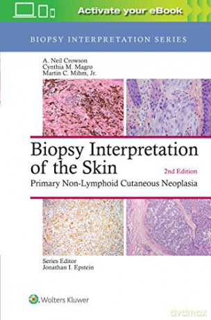 Biopsy Interpretation of the Skin: Primary Non-Lymphoid Cutaneous Neoplasia (Biopsy Interpretation Series) [KSIĄŻKA]