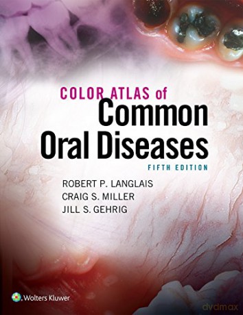 Color Atlas of Common Oral Diseases [KSIĄŻKA]