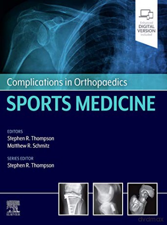 Complications in Orthopaedics: Sports Medicine - Stephen R. Thompson [KSIĄŻKA]