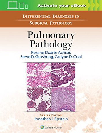 Differential Diagnosis in Surgical Pathology: Pulmonary Pathology [KSIĄŻKA]