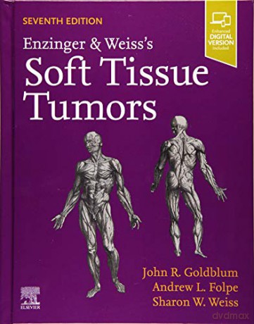 Enzinger and Weiss's Soft Tissue Tumors: Expert Consult: Online and Print - John R. Goldblum [KSIĄŻKA]