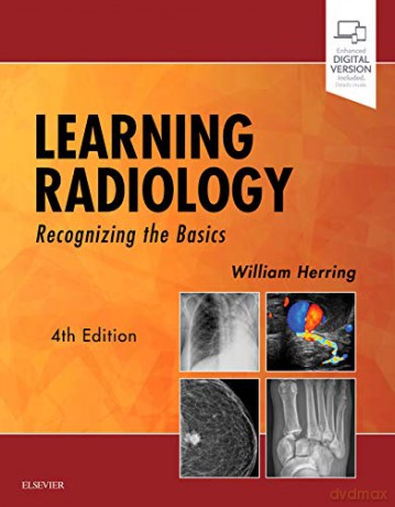 Learning Radiology: Recognizing the Basics - William Herring [KSIĄŻKA]