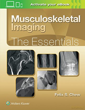 Musculoskeletal Imaging: The Essentials (Essentials Series) - Felix S. Chew [KSIĄŻKA]