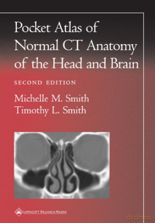 Pocket Atlas of Normal CT Anatomy of the Head and Brain (Radiology Pocket Atlas Series) - Michelle M. Smith [KSIĄŻKA]