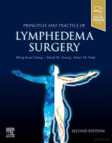 Principles and Practice of Lymphedema Surgery - Ketan M Patel [KSIĄŻKA]