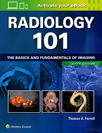 Radiology 101: The Basics and Fundamentals of Imaging [KSIĄŻKA]