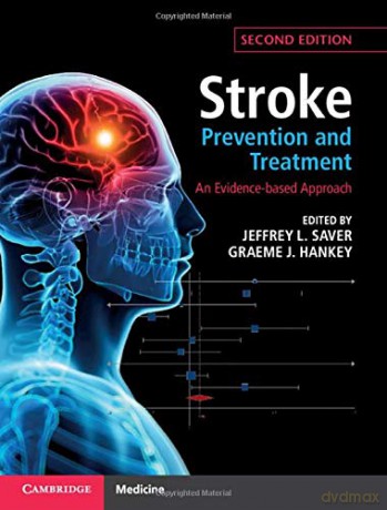 Stroke Prevention and Treatment: An Evidence-based Approach - Jeffrey L. Saver [KSIĄŻKA]