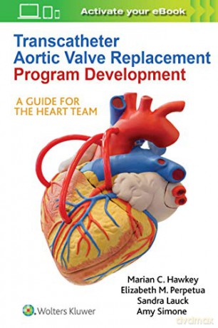 Transcatheter Aortic Valve Replacement Program Development: A Guide for the Heart Team - Marian C Hawkey [KSIĄŻKA]