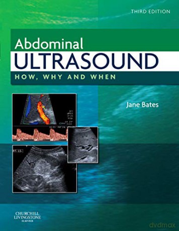 Abdominal Ultrasound: How, Why and When, 3e - Jane A. Smith (formerly Bates) MPhil DMU DCR [KSIĄŻKA]