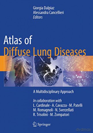 Atlas of Diffuse Lung Diseases: A Multidisciplinary Approach - Giorgia Dalpiaz [KSIĄŻKA]