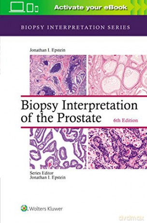 Biopsy Interpretation of the Prostate (Biopsy Interpretation Series) - Jonathan I. Epstein [KSIĄŻKA]