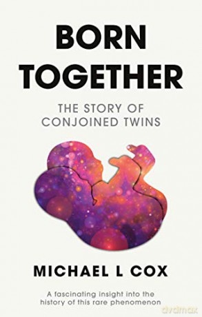 Born Together: The Story of Conjoined Twins - Michael L Cox [KSIĄŻKA]