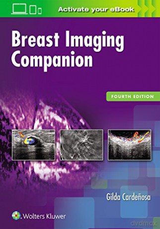 Breast Imaging Companion - Gilda Cardenosa [KSIĄŻKA]