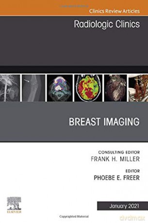 Breast Imaging, An Issue of Radiologic Clinics of North America (Volume 59-1) (The Clinics: Radiology, Volume 59-1) - Phoebe Freer [KSIĄŻKA]