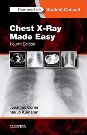 Chest X-Ray Made Easy, 4e - Jonathan Corne MA PhD MB BS FRCP [KSIĄŻKA]