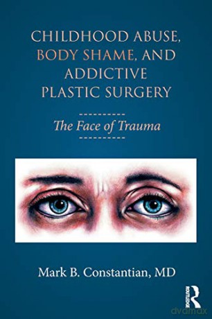 Childhood Abuse, Body Shame, and Addictive Plastic Surgery: The Face of Trauma - Mark B. Constantian [KSIĄŻKA]