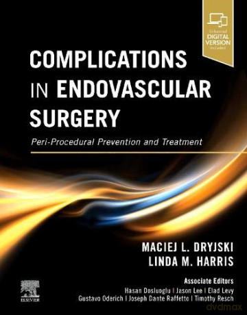 Complications in Endovascular Surgery: Peri-Procedural Prevention and Treatment - Maciej Dryjski MD PhD FACS [KSIĄŻKA]