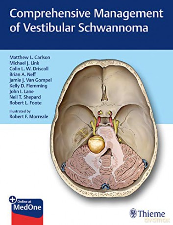 Comprehensive Management of Vestibular Schwannoma - Matthew L. Carlson [KSIĄŻKA]