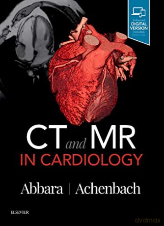 CT and MR in Cardiology, 1e - Suhny Abbara MD FACR FSCCT [KSIĄŻKA]