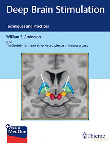 Deep Brain Stimulation: Techniques and Practices - William S. Anderson [KSIĄŻKA]