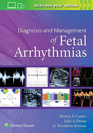 Diagnosis and Management of Fetal Arrhythmias - Bettina Cuneo [KSIĄŻKA]