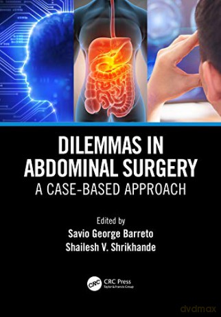 Dilemmas in Abdominal Surgery: A Case-Based Approach - Savio George Alberto da Piedade Barreto [KSIĄŻKA]