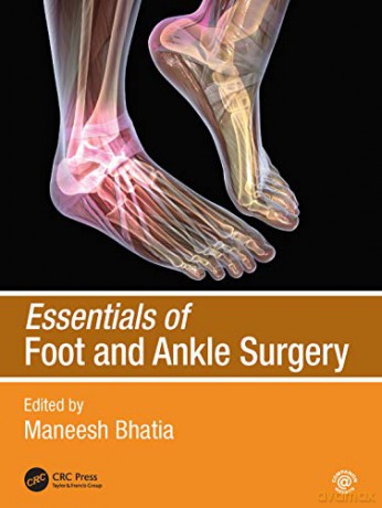 Essentials of Foot and Ankle Surgery - Maneesh Bhatia [KSIĄŻKA]