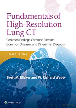 Fundamentals of High-Resolution Lung CT: Common Findings, Common Patterns, Common Diseases and Differential Diagnosis (Pocket Notebook) - Brett M Elicker MD [KSIĄŻKA]