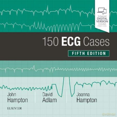 150 ECG Cases, 5e, Paperback - John Hampton DM MA DPhil FRCP FFPM FESC [KSIĄŻKA]
