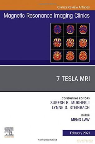 7T MRI, An Issue of Magnetic Resonance Imaging Clinics of North America (Volume 29-1) (The Clinics: Radiology, Volume 29-1) - Meng Law MD [KSIĄŻKA]