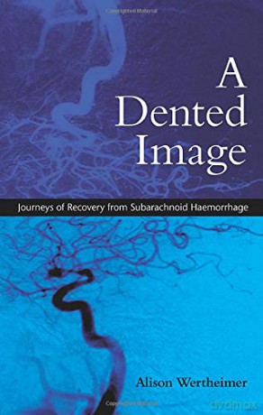 A Dented Image: Journeys of Recovery from Subarachnoid Haemorrhage - Alison Wertheimer [KSIĄŻKA]