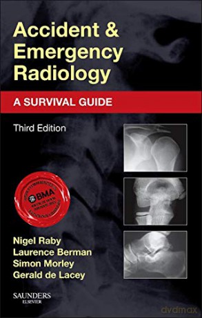 Accident and Emergency Radiology: A Survival Guide, 3e: Expert Consult - Nigel Raby FRCR [KSIĄŻKA]
