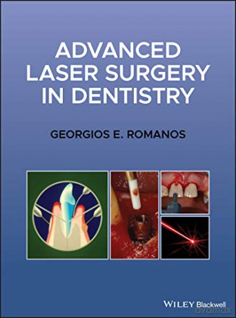 Advanced Laser Surgery in Dentistry - Georgios E. Romanos [KSIĄŻKA]