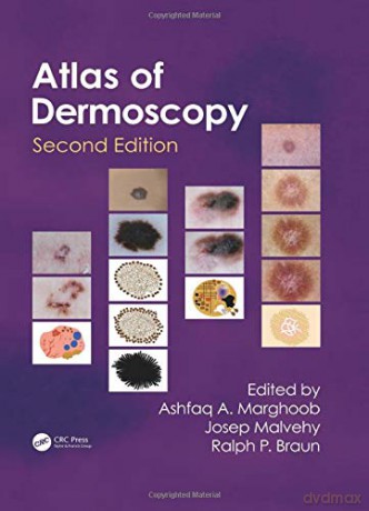 An Atlas of Dermoscopy - Ashfaq A Marghoob [KSIĄŻKA]