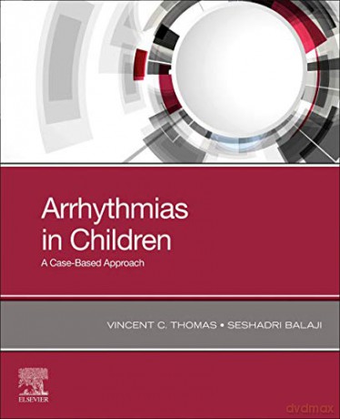 Arrhythmias in Children: A Case-Based Approach - Vincent C. Thomas MD MHA [KSIĄŻKA]