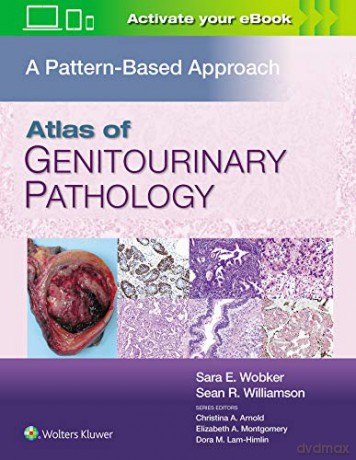 Atlas of Genitourinary Pathology: A Pattern Based Approach - Wobker MD MPH [KSIĄŻKA]