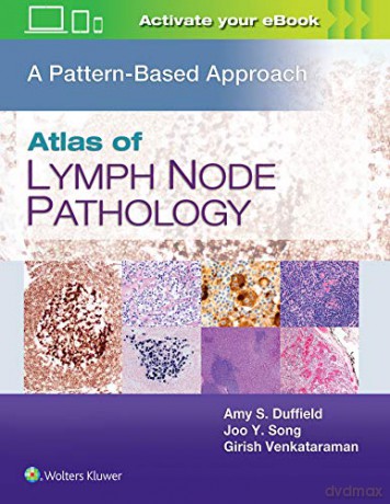 Atlas of Lymph Node Pathology: A Pattern Based Approach - Duffield MD [KSIĄŻKA]
