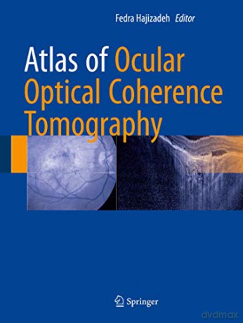 Atlas of Ocular Optical Coherence Tomography - Fedra Hajizadeh [KSIĄŻKA]